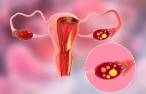 5th World Congress on Gynecology, Obstetrics & Women Health